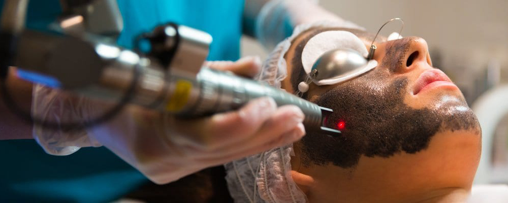 Tratamiento de Hollywood Peel (Láser) Hollywood Peel (Láser)