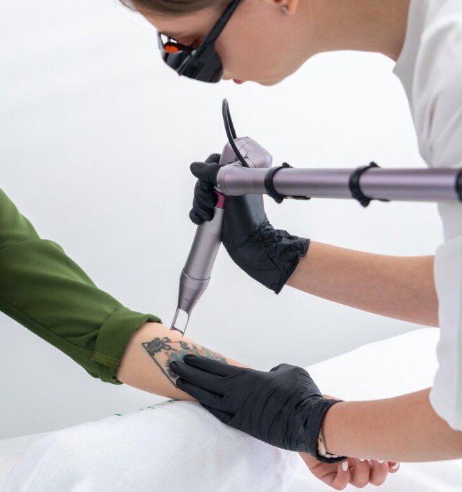 Tratamiento de Retirada de Tatuajes con Láser Retirada de Tatuajes con Láser